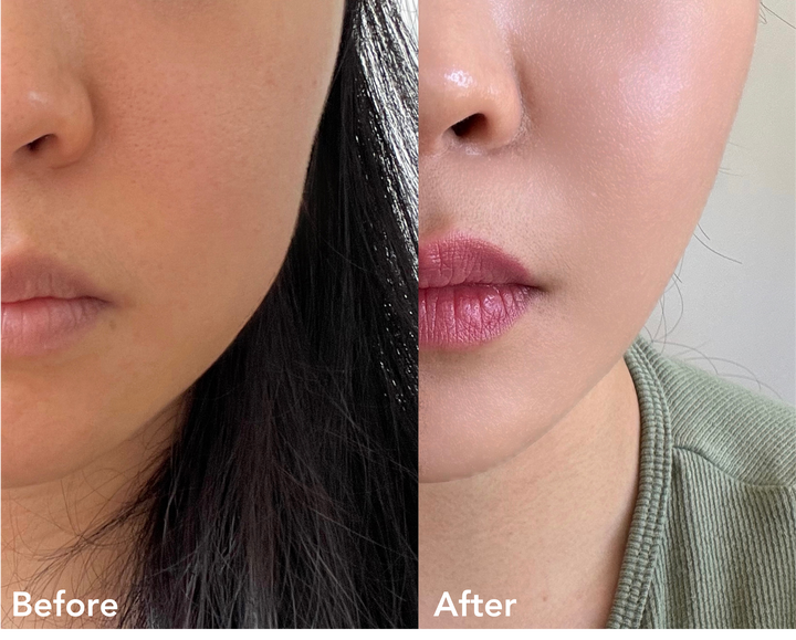 Microcurrent Facial Sculpting Roller