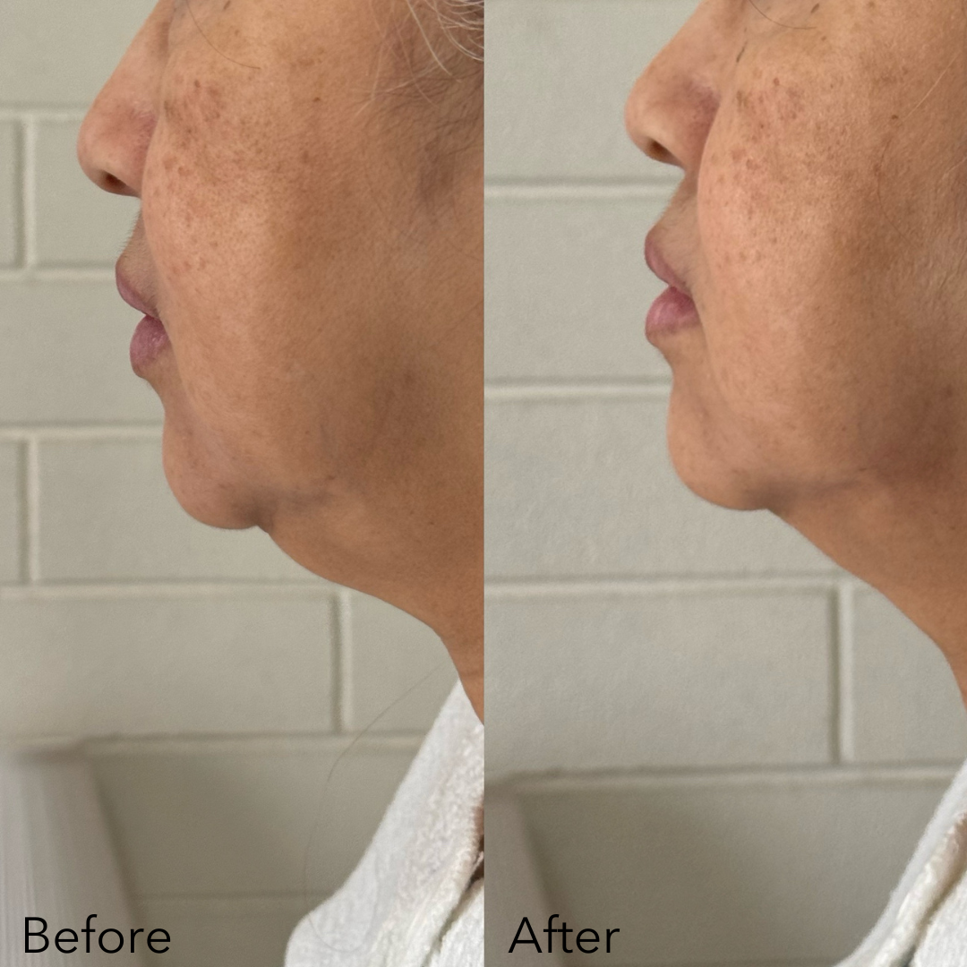 Lift & Glow Bundle (NEW)