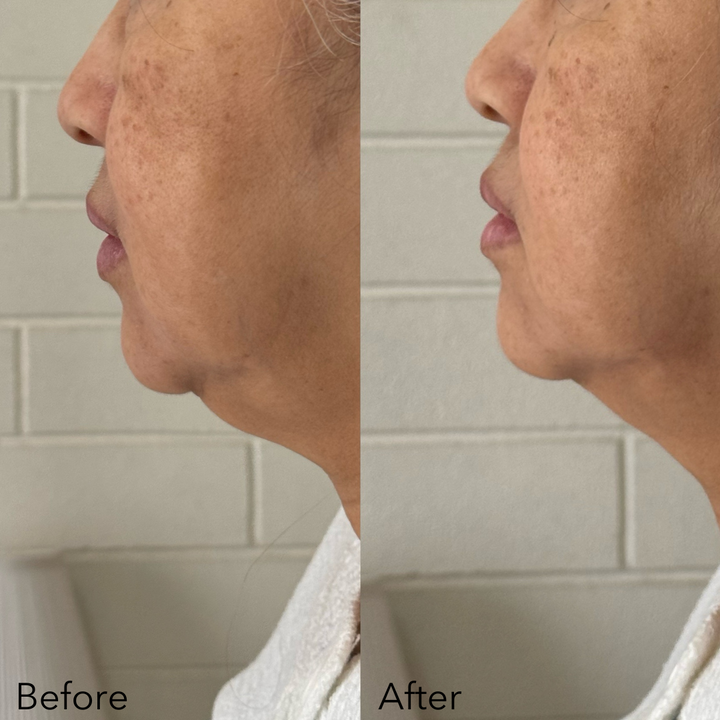 Lift & Glow Bundle (NEW)