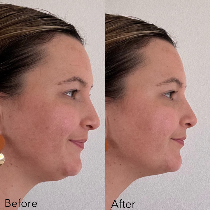 Advanced Dermal Sculpting Mask (10 Masks)