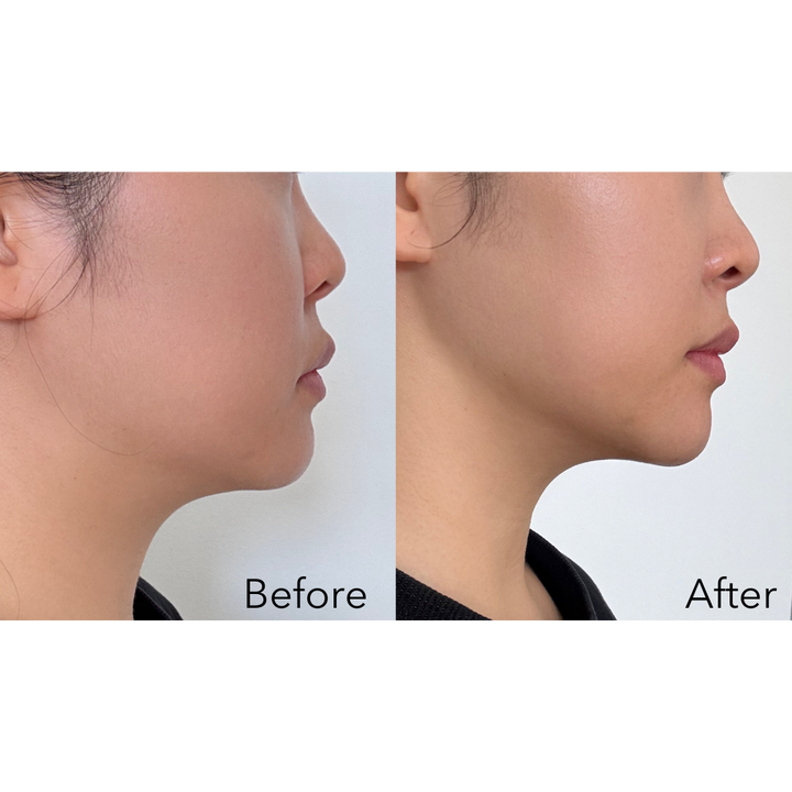Advanced Dermal Sculpting Mask (10 Masks)