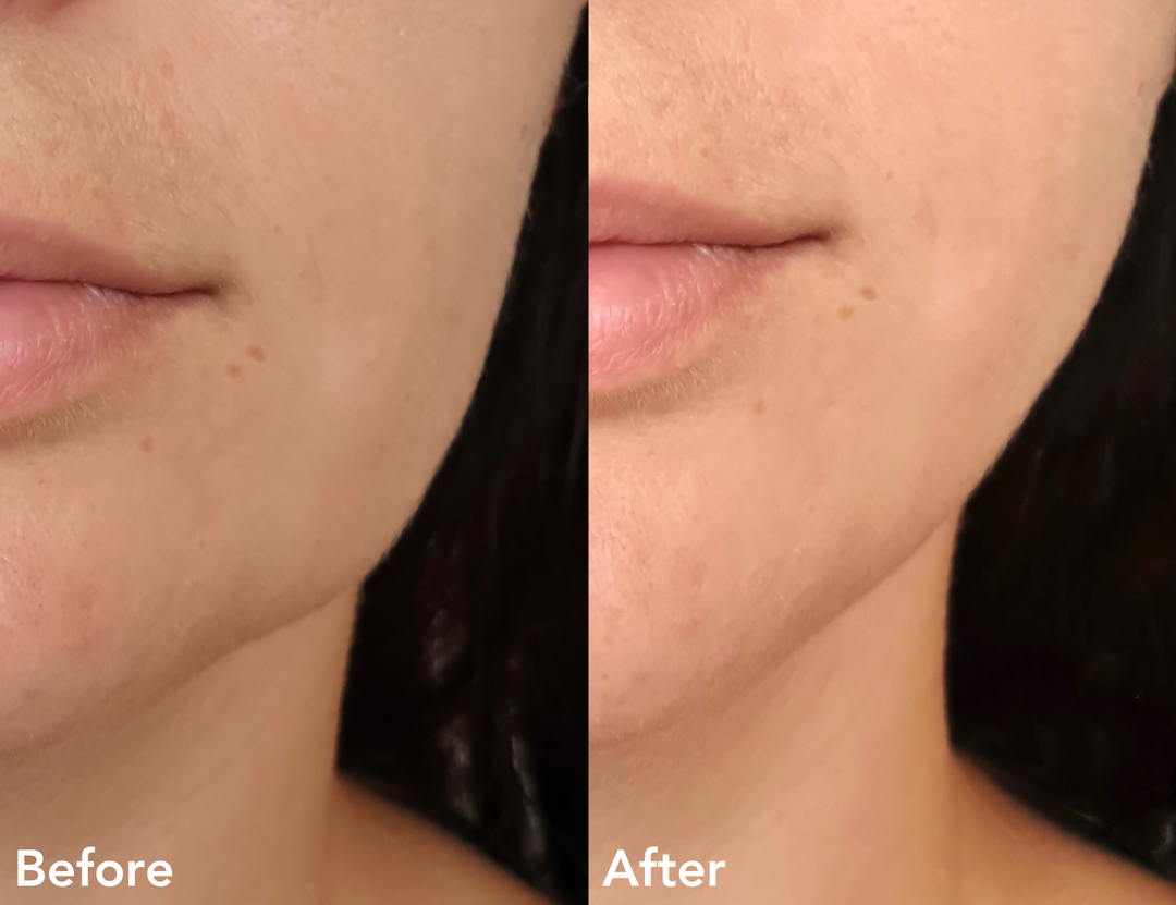 Microcurrent Facial Sculpting Roller